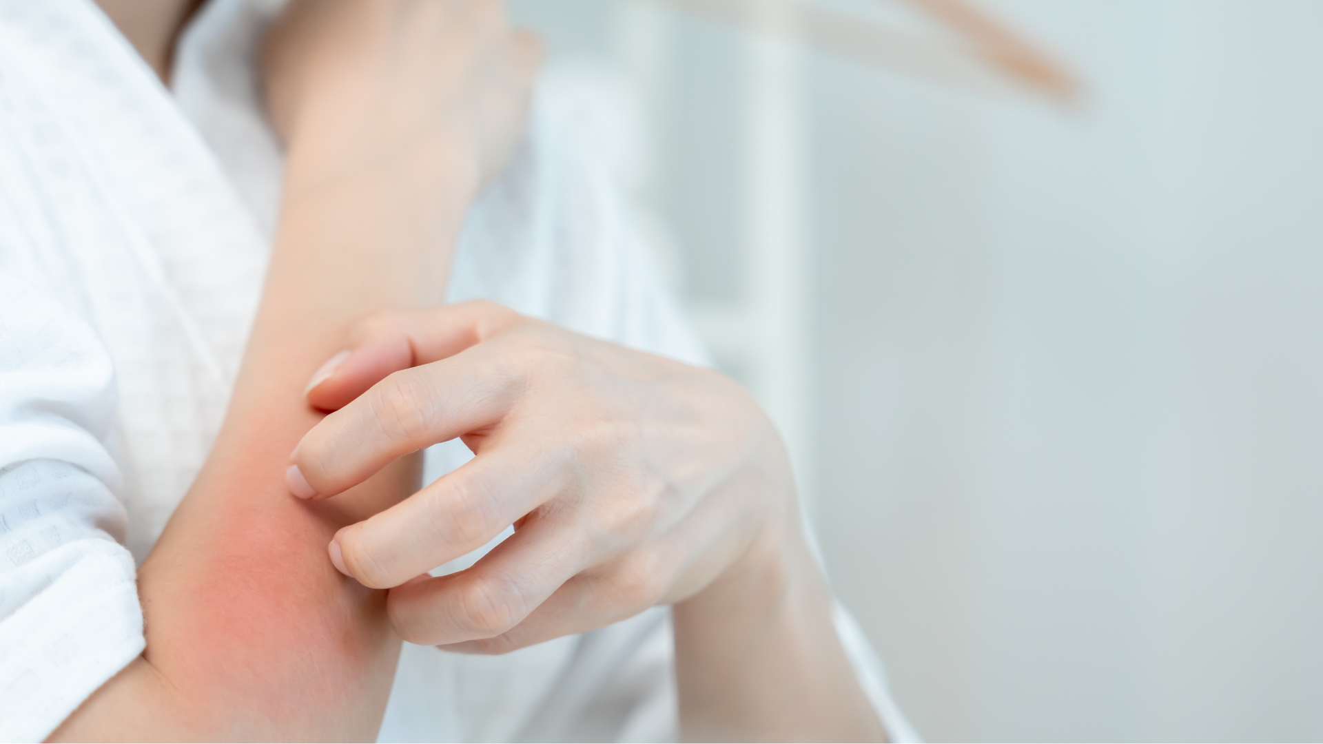 égési sérülés_02.png